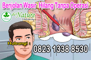 Krim Lotion Obat Ambeien Paling Ampuh Menghilangkan Benjolan Wasir https://sediaobatwasir.blogspot.com/2019/09/krim-lotion-obat-ambeien-paling-ampuh.html