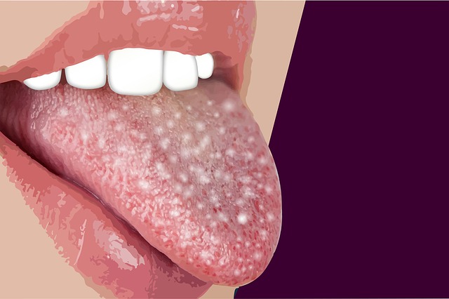 Ketahui penyebab bau mulut dan cara untuk hilangkan bau mulut
