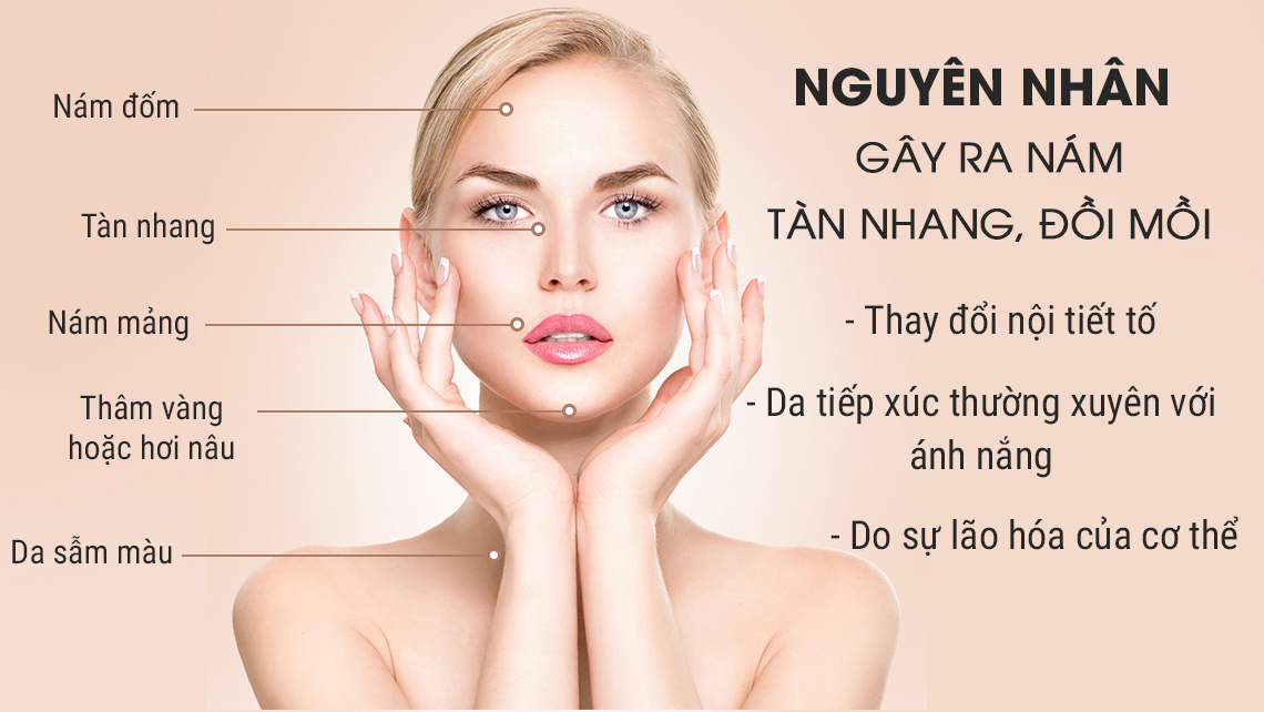 Những nguyên nhân gây nám tàn nhang và cách ngăn ngừa điều trị | Blog trị  nám, hướng dẫn trị nám, thuốc trị nám tại nhà