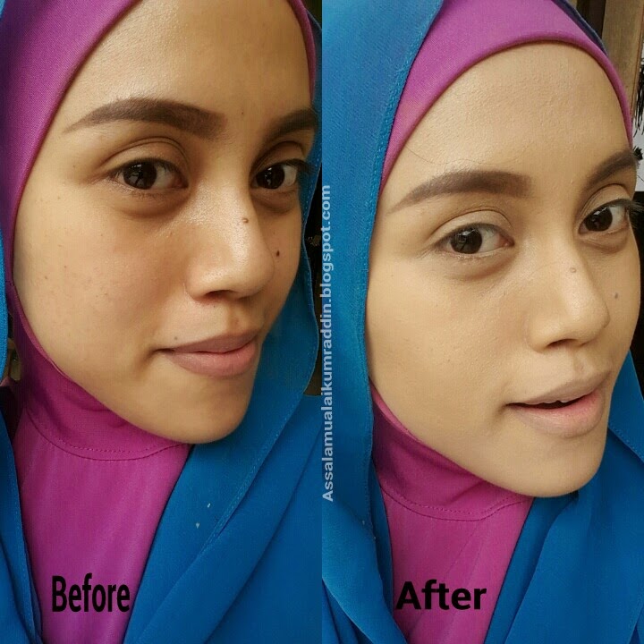 JAMPI DAN TIPS KESEHATAN: Cara Menghilangkan Noda Hitam di Wajah Pakai