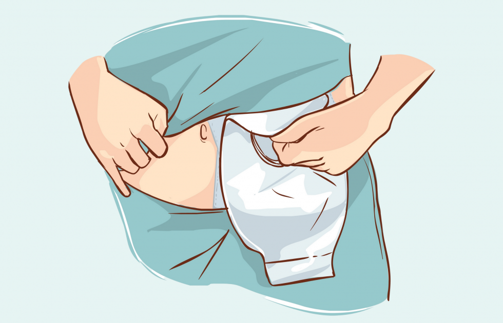 Ostomy Log Tips To Attach An Ostomy Pouch