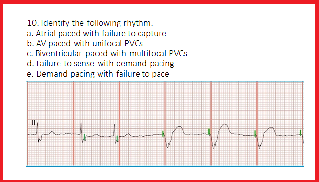 ventricular paced rhythm with failure to capture ventricular paced rhythm with failure to capture