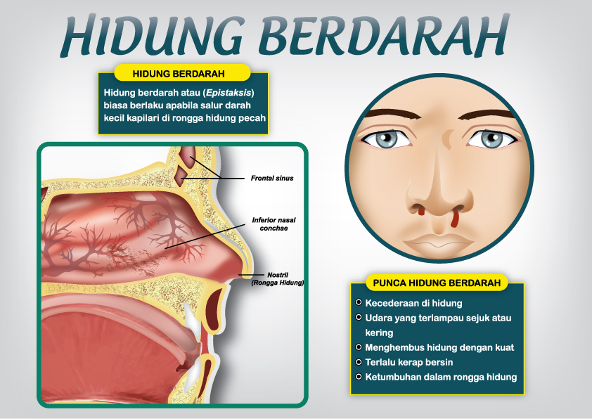 20+ Arti Mimpi Hidung Keluar Darah Sebelah Kanan