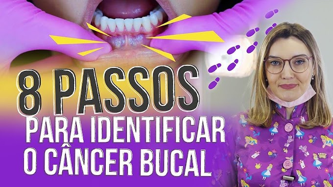 CÂNCER BUCAL: 8 Passos para identificar - Dra. Aline