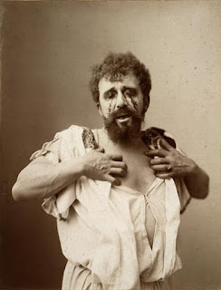 A black and white photo of an actor playing Oedipus with eyes gauged out.