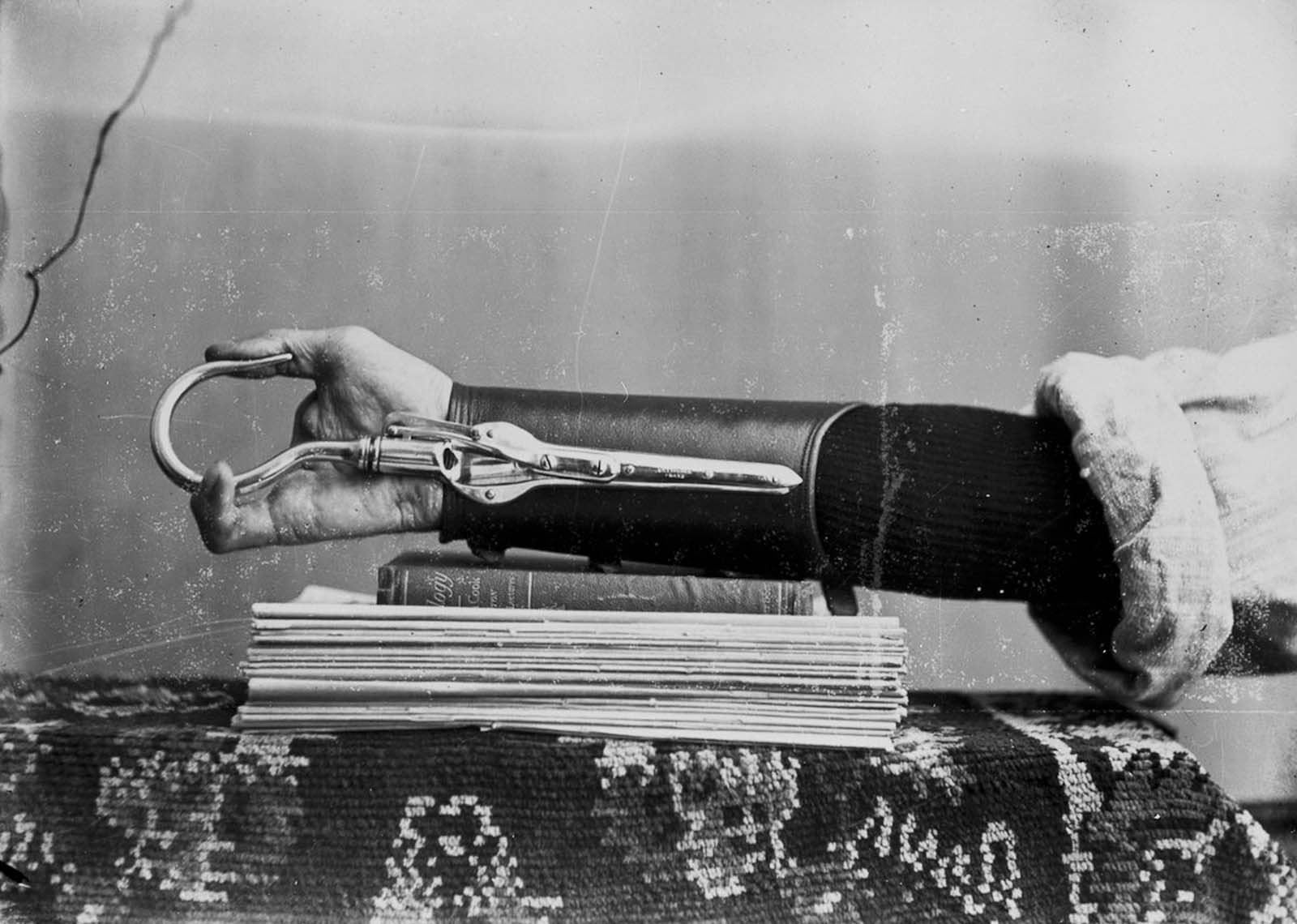 The extraordinary early prostheses made by James Gillingham  1900 - 1