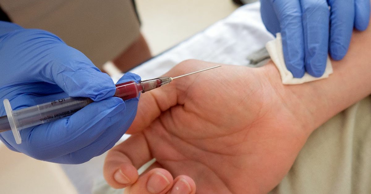 Arterial Puncture for Blood Gas Analysis Nurses procedure by