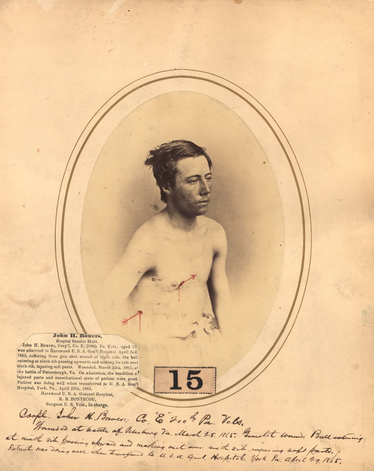 Eerie Vintage Portraits of Wounded Soldiers During the American Civil War Vintage Everyday