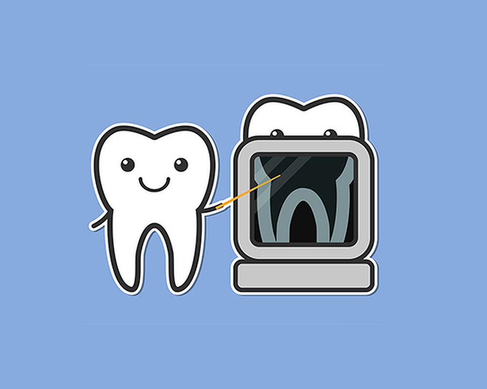 Are dental xrays safe? They are necessary? OdontoVida Are dental xrays safe? They are necessary? OdontoVida