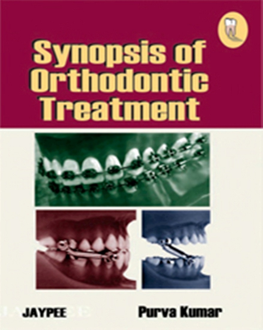 Adult functional orthodontics for tmj image