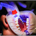 Dental Care Treatments That Make it Easier to Take Care of Your Teeth