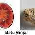 Apakah Nama obat kencing batu Murah Di Seluruh Apotik