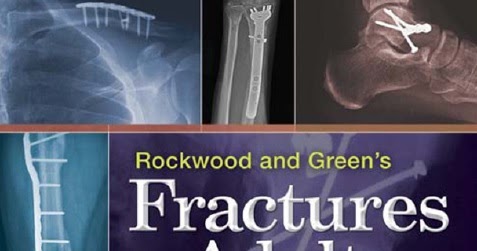 Adult fracture green in rockwood set volume