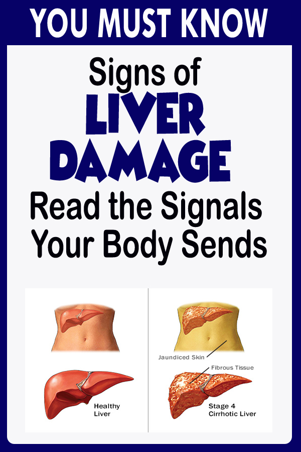 Liver Damage Signs And Symptoms