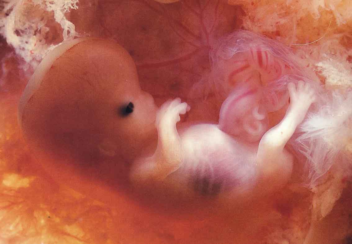 12 недель и 6 дней. Эмбрион на 10 неделе беременности. Абортированный зародыш 12 недель. 10 Недель беременности фото плода. Плод в 10 недель -12 недель беременности.