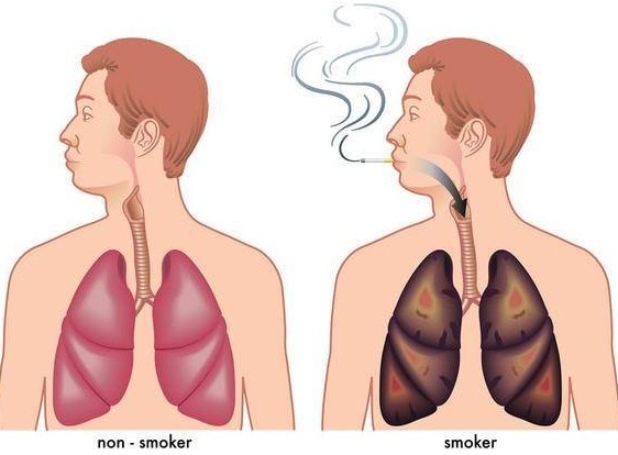 Cara Ampuh Menghilangkan Polusi Asap di Dalam Paru Paru Kita Cara Ampuh Menghilangkan Polusi Asap di Dalam Paru Paru Kita