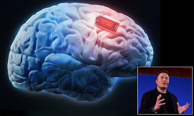 tecnologyknowledge9907/ELON MUSK IS NUEROLOGICAL BRAIN CHIP