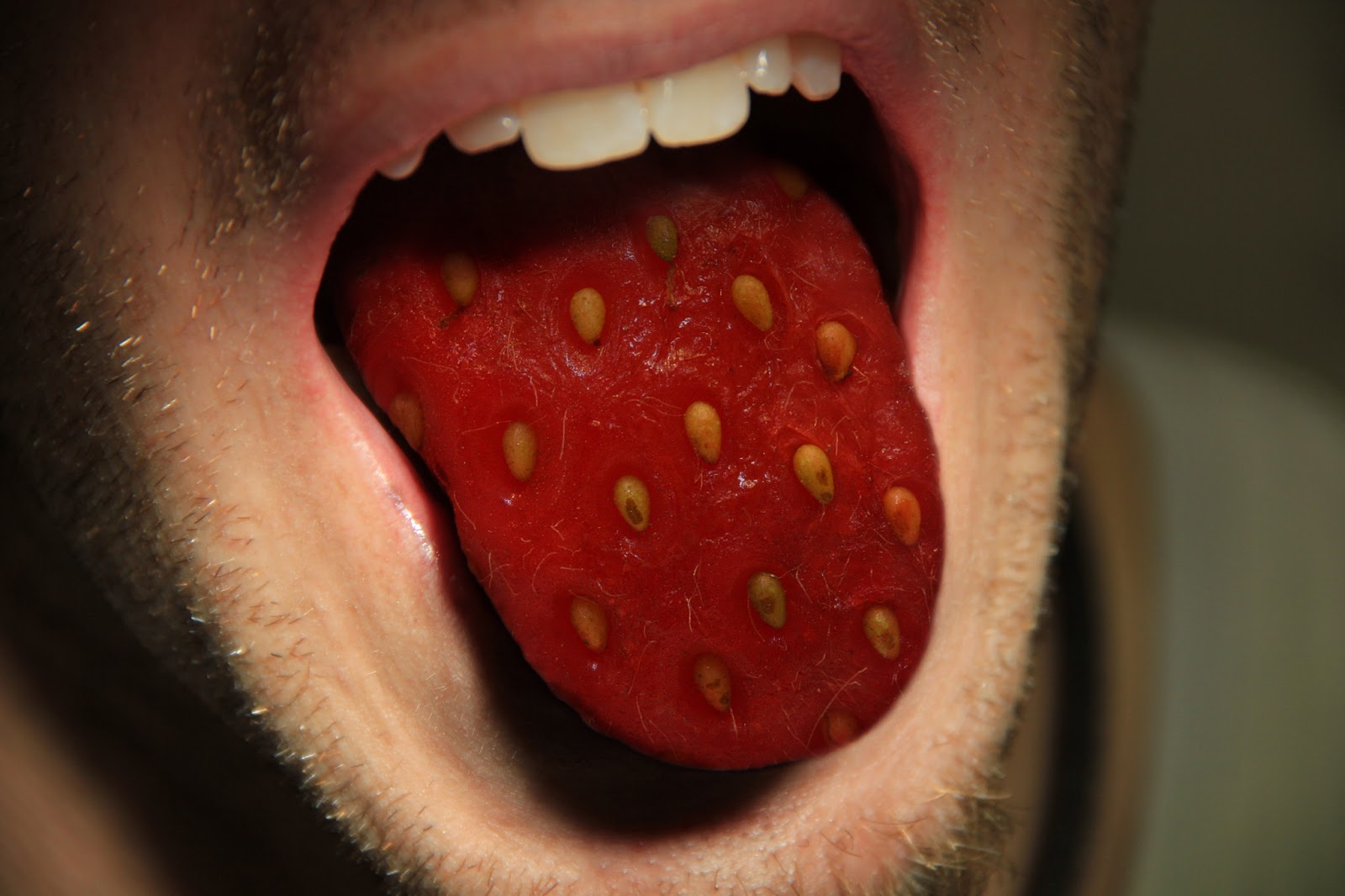 Strawberry Tongue Causes Symptoms Treatment And More vrogue.co