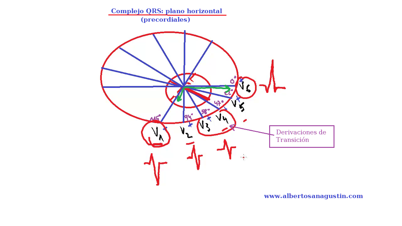 Complejo QRS en derivaciones horizontales, electrocardiograma normal