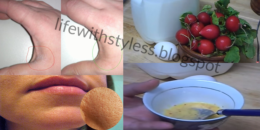 Homemade Natural Face mask for dry skin and open pores Life With Styles