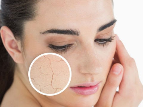 Nhận biết chính xác dấu hiệu của một làn da cần dưỡng ẩm
