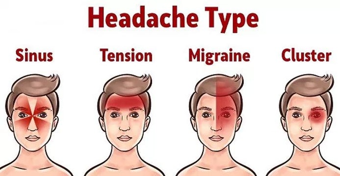 Here's How Headaches Reveal Health Problems (And How To Treat Them ...