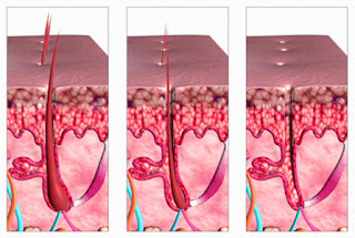 hair growth hair follicle