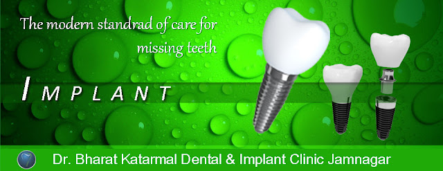 dental implant clinic at jamnagar