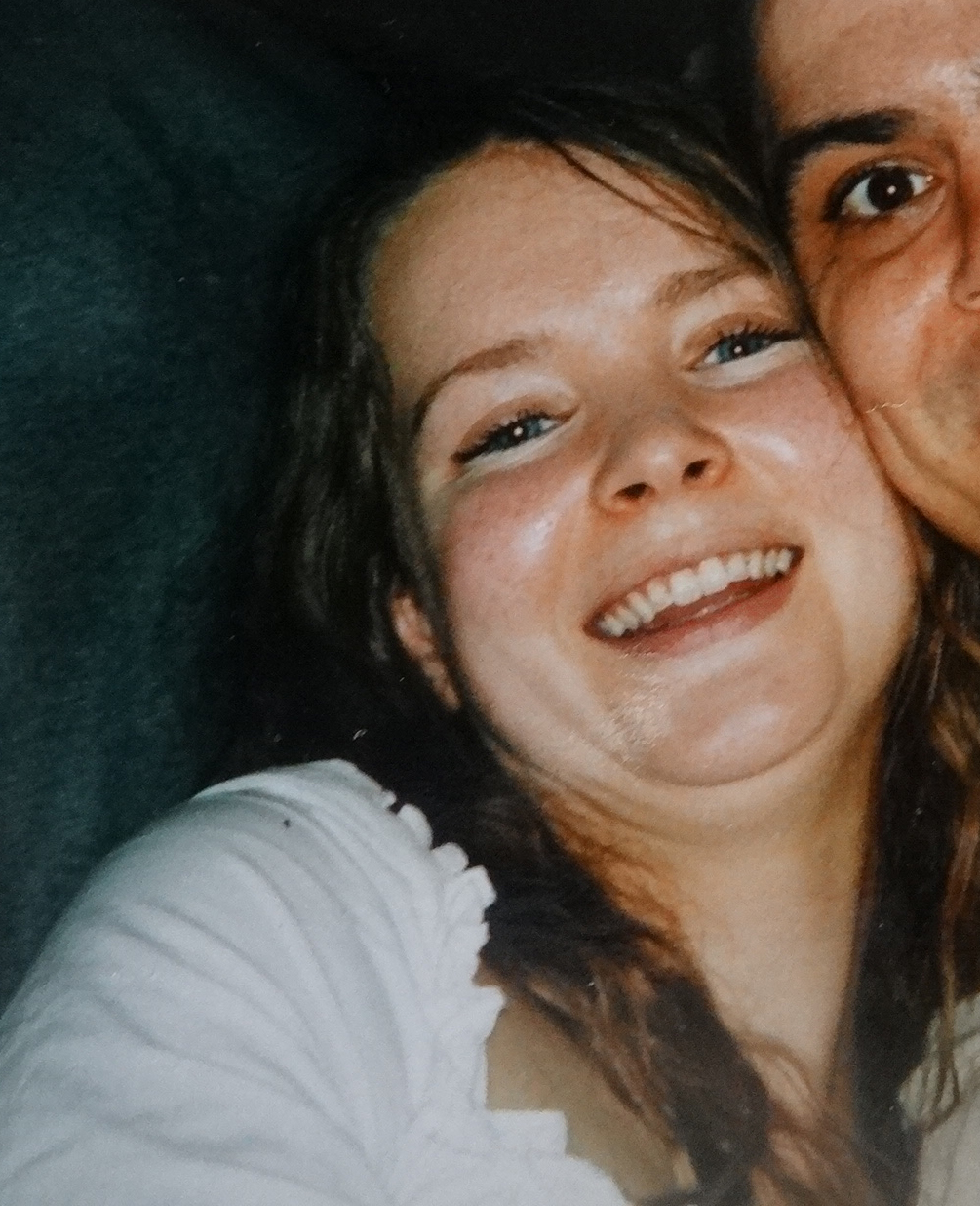 Scarlet Letters, dealing with vascular rosacea, face flushing, burning