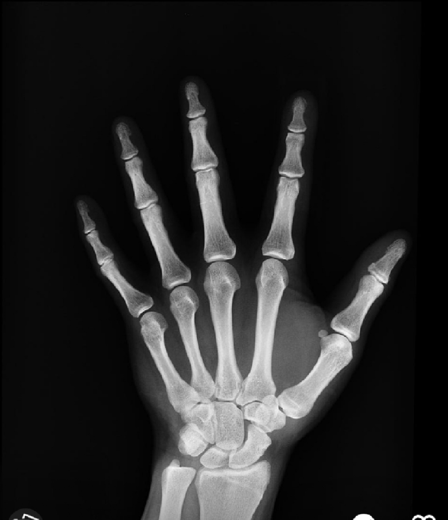 Causes of Cancer and its detection /diagnosis and treatment