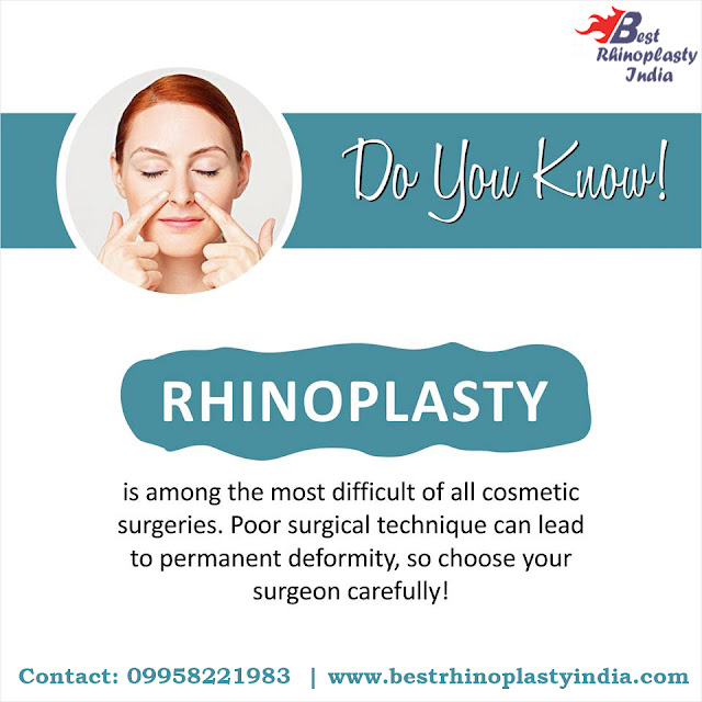 #rhinoplastysurgery, #nosesurgery, #nosereconstruction, #nosejob, #nosereconstruction, #rhinoplastysurgeoncost, #southdelhi, #nasalsurgery ,  #augmentation,  #before_after,  #dorsal_hump, #cleft_revision,  #asian, #celebrity, #african_american, #tipnose, #koreanrhinoplasty,  #ethnic