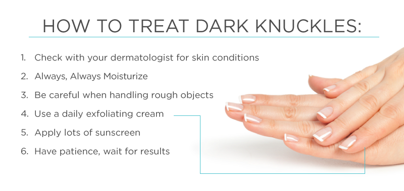 Natural Dark Spot Removal Knees Natural Dark Spot Removal Knees