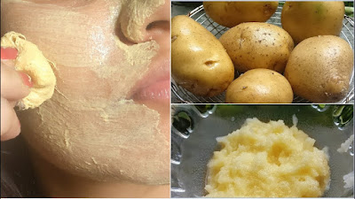 Home Tricks With Potatoes To Remove Stains On The Face Home Tricks With Potatoes To Remove Stains On The Face