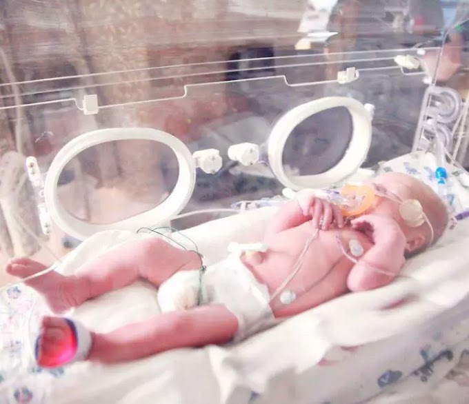 What is considered a premature baby?