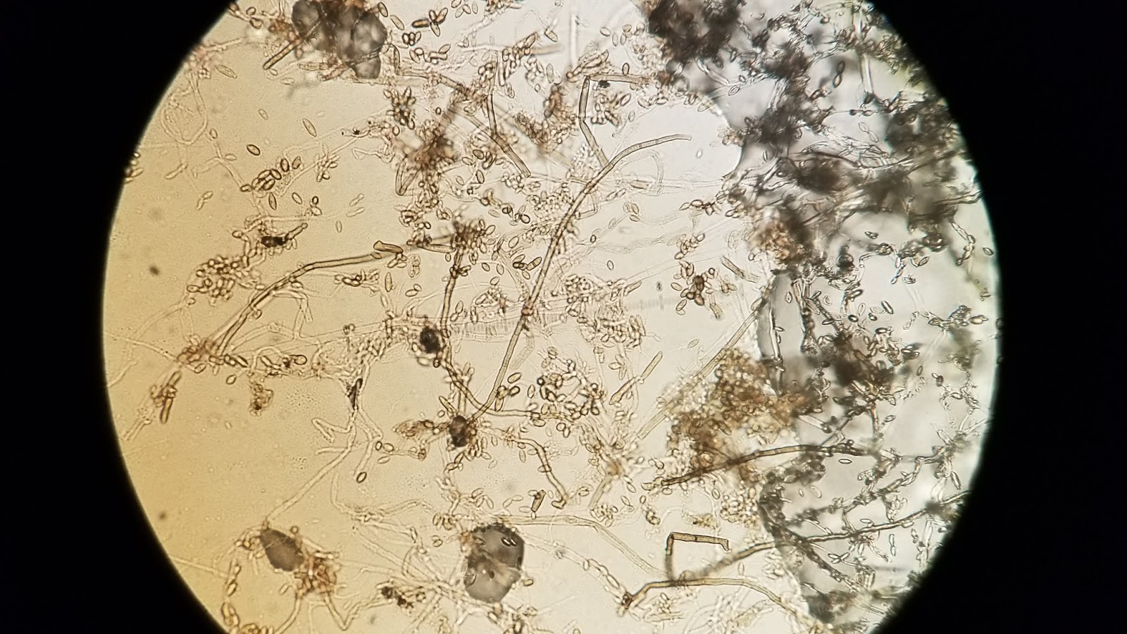 Sustainable Mycology Black Raspberries multiple molds