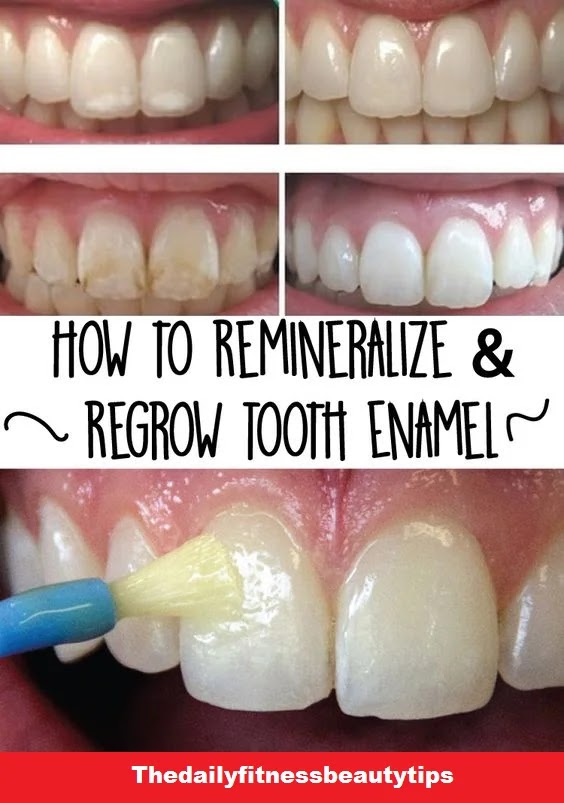 How to Remineralize Teeth and Regrow Tooth Enamel Naturally?