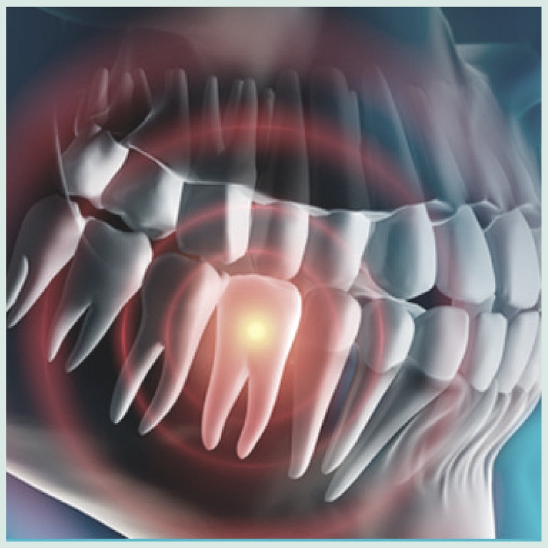 Исцеления зубов. 3d снимок челюсти стоматологии. Квантовое исцеление зубов.