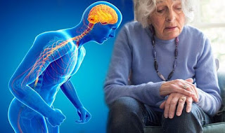 Parkinson's disease Symptoms and Causes