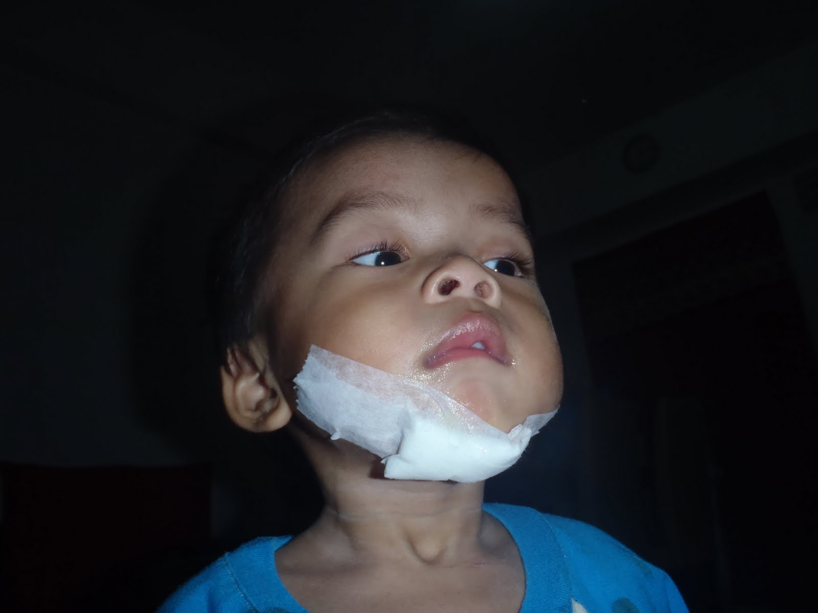 Ubat Tahan Sakit Untuk Luka  Sinter B