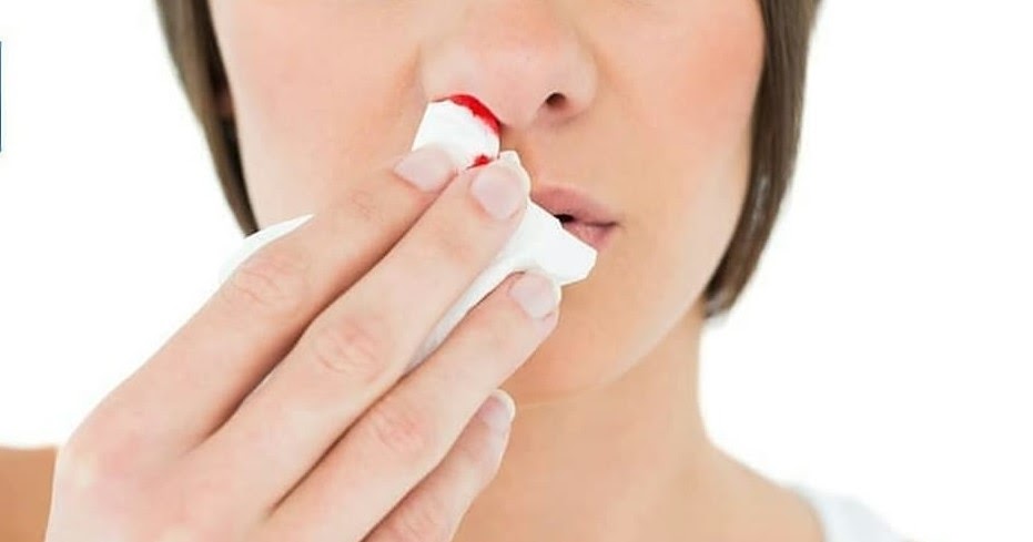 MIMISAN, Ini Penyebab dan Cara Yang Tepat Mengatasi Mimisan Sendiri di