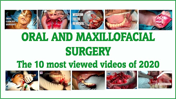 ORAL AND MAXILLOFACIAL SURGERY: The 10 most viewed videos of 2020
