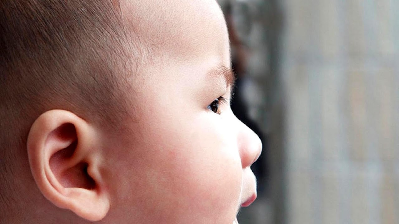 Bright Yellow Ear Discharge Yellow Choices