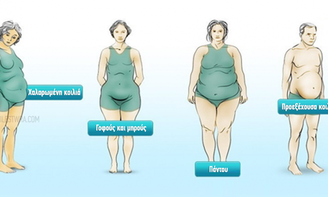 4 τύποι παχυσαρκίας και τι λένε για την υγεία σας Obesity