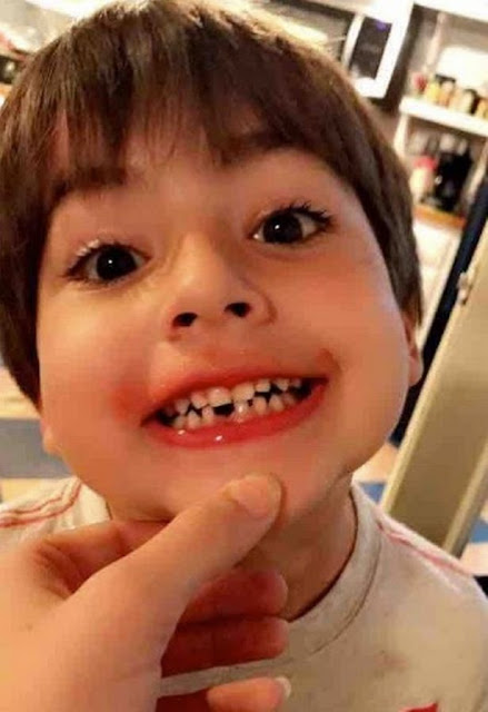 6-year-old boy mauled to death by an abandoned Pitbull brought by his Mother