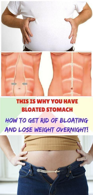 I Always Had a Swollen Stomach, Until I Learned About These Five Habits