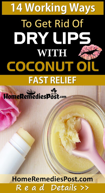 14 Ways To Use Coconut Oil For Chapped Lips Coconut Oil For Chapped Lips, Chapped Lips, Dry Lips, How To Get Rid Of Chapped Lips, How To Get Rid Of Dry Lips, How To Cure Chapped Lips, Chapped Lips Remedy, Home Remedies For Chapped Lips, Home Remedies For Dry Lips, How To Treat Chapped Lips, Chapped Lips Treatment, Chapped Lips Home Remedies, Remedy For Chapped Lips, Cure Chapped Lips,