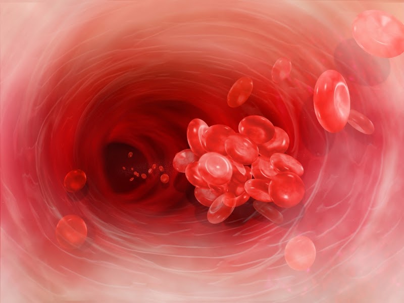 How to Prevent Blood Clots and Avoid Sudden Death Independent