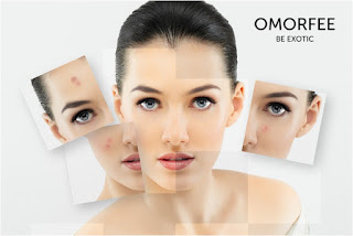 http://www.omorfee.com/holistic-care/skin-brightening-clarifying-essential-oil-therapy