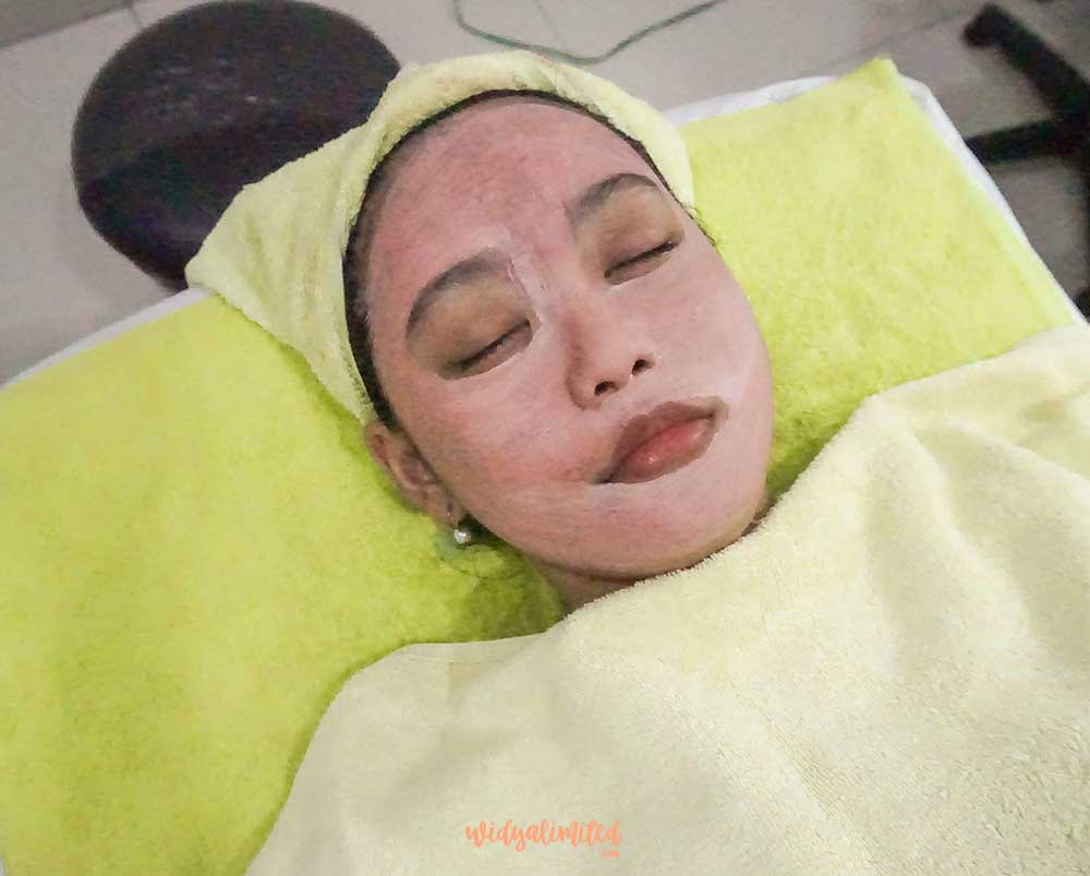 Acne Facial Di Naavagreen Clinic Murah Meriah Bahasa Indonesia Widyalimited