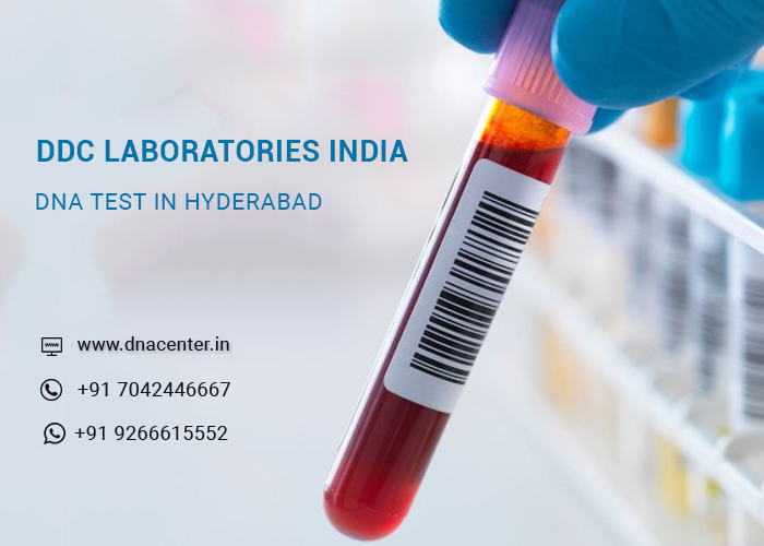 DNA TEST IN HYDERABAD
